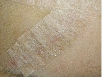 船橋　ユーカリ　クリニック　皮膚科　形成外科　切り傷