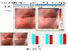 船橋　ユーカリ　クリニック　皮膚科　形成外科　エレクトロポレーション