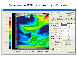 船橋　ユーカリ　クリニック　皮膚科　形成外科　お腹　たるみ　超音波