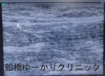 千葉　船橋　しこり　腫瘍　腫瘤　虫刺され
