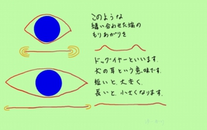 ほくろ　手術　船橋　千葉